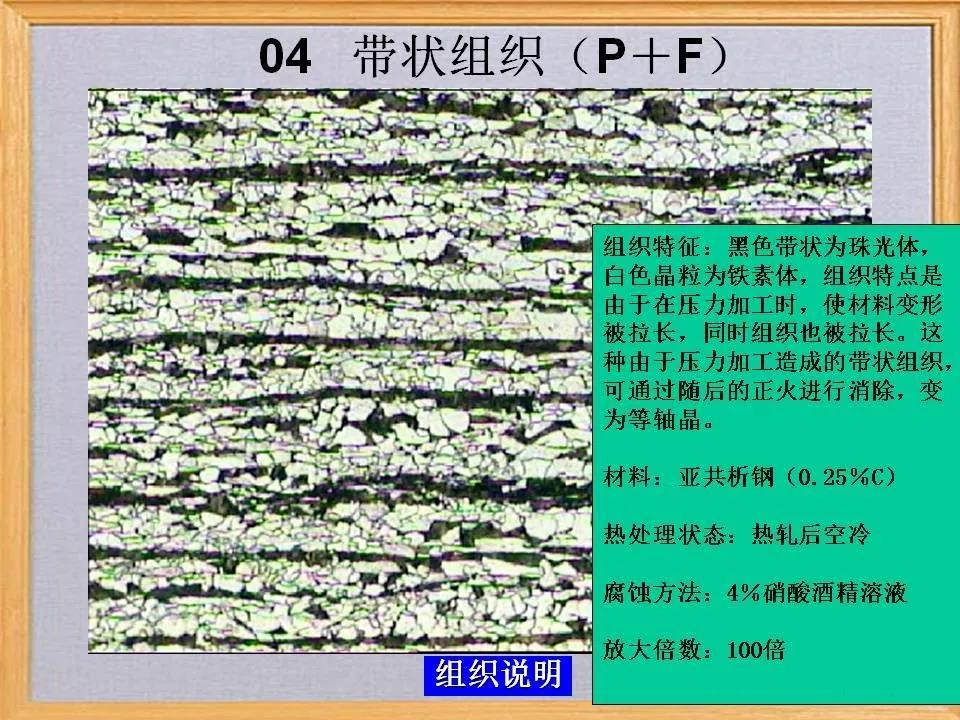 带状组织4.jpg