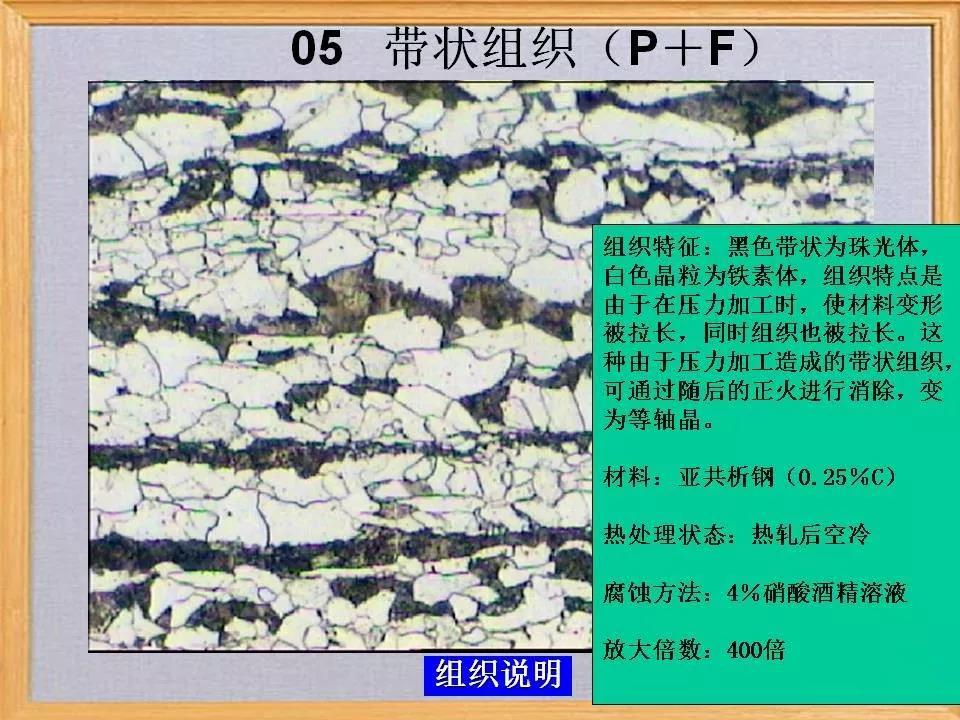 带状组织5.jpg