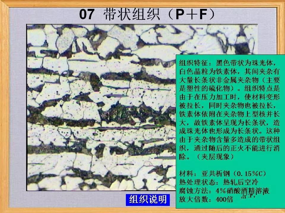 带状组织7.jpg