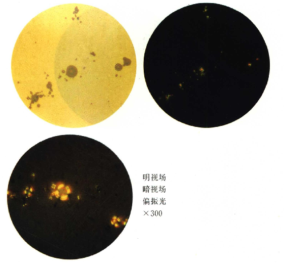 夹杂物1.png